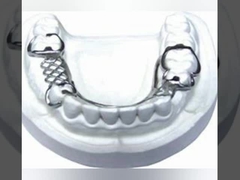 Система моста 3D цифров лаборатории PFM Denture зубоврачебная зубоврачебная Intraoral просматривая отображая