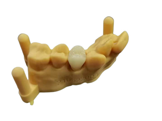 OEM 3D печатая дизайн цифров лаборатории гибкого акрилового Denture зубоврачебный