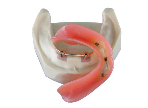 Безопасность лаборатории высокого биологического взаимо- Denture удобосмешиваемости зубоврачебная имплантирует