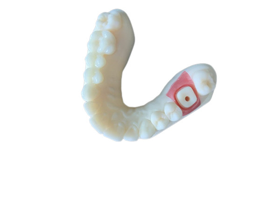 Высокий зуб кроны Zirconia стабильности PFM пятнает устойчивый для исследования