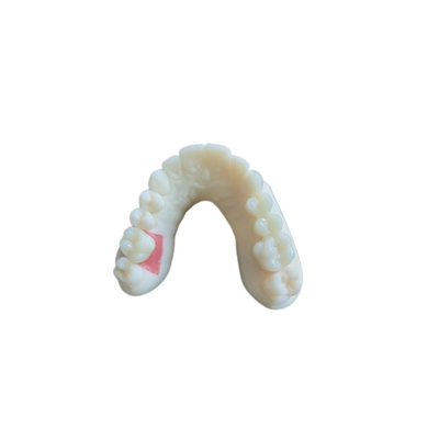 Цифровое сканирование полости рта PFM Dental Crowns Bridge Требования имплантологии