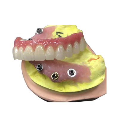 Имплантируйте крону Zirconia устоя зубоврачебную естественную совсем на 4 Dentures