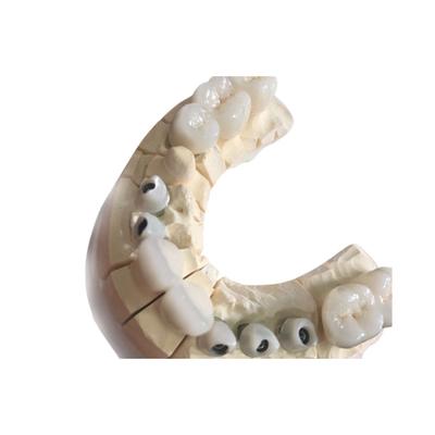Кроны превосходное Biocompatibility свободного белого Zirconia металла зубоврачебные