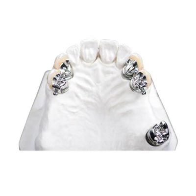Denture легкого чистого приложения точности OEM частично пятнает устойчивый