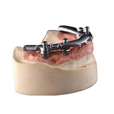 Твердость Dentures зубных имплантатов высокой плотности PFM сильная продолжительная