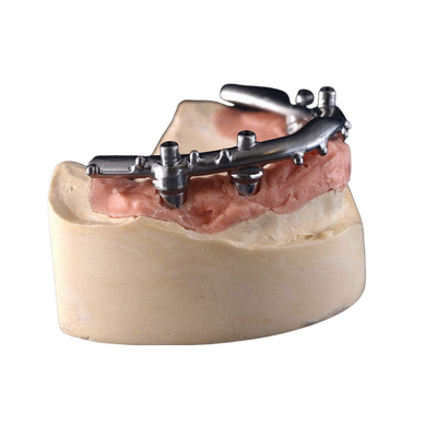 CNC титана All-On-4 имплантирует обеспеченные Dentures для зубоврачебной клиники