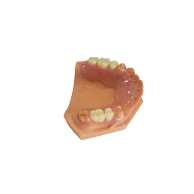 3D напечатало Dentures для зубоврачебных лабораторий основанных на цифровых данных