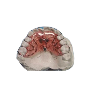 Расчалки безопасных фиксированных Aligners легкие очищая съемные фиксированные ортодонтические