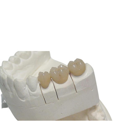 Временная крона 3D CAD/CAM PFM зубоврачебная печатая изготовление на заказ Denture дизайна