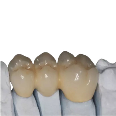 Подгонянное OEM красивое зубов фарфора Zirconia высокопрочное прочное