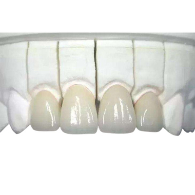 3D напечатало Biocompatible зубоврачебной кроны Zirconia износоустойчивое сильно