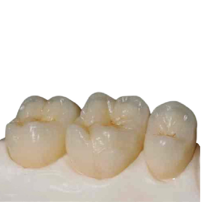 Точность цифров зубов высокопрочного Zirconia керамическая изготовленное