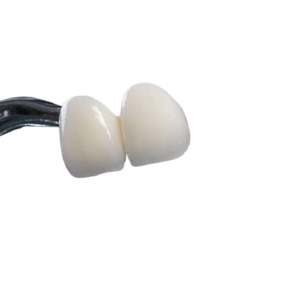 Крона хорошего Zirconia Biocompatibility зубоврачебная не раздражая легкую чистку
