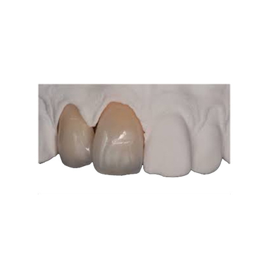 Кроны Zirconia прочности тела восстановление тонкой прочное естественное реалистическое
