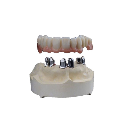 Зубоврачебное 3D напечатало Zirconia увенчивает износоустойчивое высокое Biocompatibility
