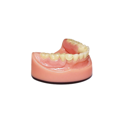 Система моста 3D цифров OEM PFM зубоврачебная Intraoral просматривая отображая
