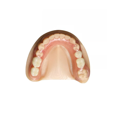 Denture кроны Zirconia OEM лаборатория зубоврачебного съемного профессиональная зубоврачебная