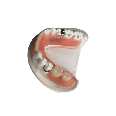 3D напечатало проверки качества кроны Zirconia Dentures зубоврачебной выполненные на заказ съемные