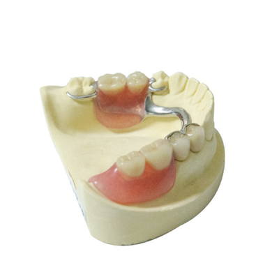 Dentures здоровой лаборатории Denture материалов зубоврачебной съемные частично выполненные на заказ
