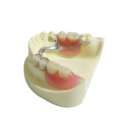 Замен продуктов лаборатории CE Dentures зубоврачебных пластиковые съемные частично