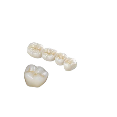Коррозионная устойчивость высокое Biocompatibility зубоврачебной кроны зуба Zirconia сильная