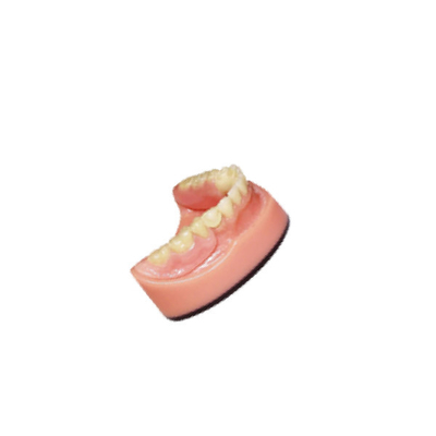 Система моста 3D цифров лаборатории PFM Denture зубоврачебная зубоврачебная Intraoral просматривая отображая