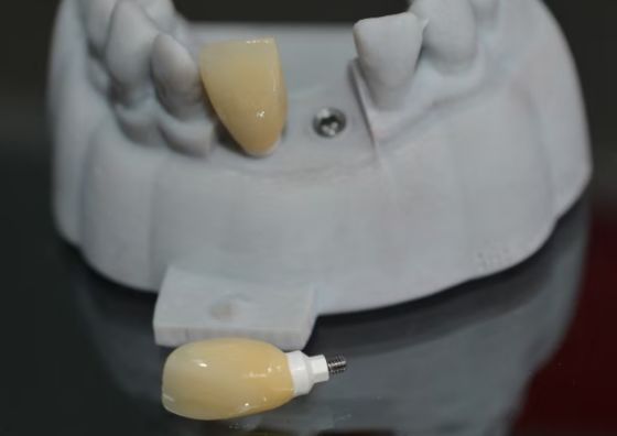 CAD PEEK специальный фундамент