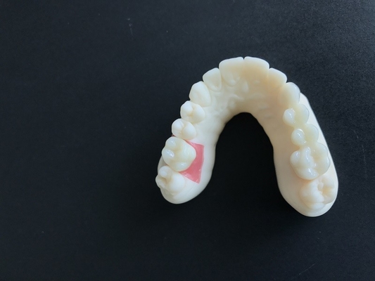 Цифровое сканирование полости рта PFM Dental Crowns Bridge Требования имплантологии