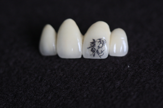 PFM Dental Crown Image Настройка с персонализированными индивидуальными узорами