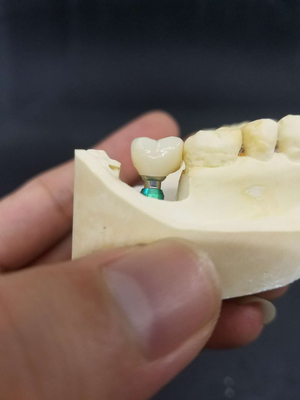 Ровная поверхностная Biocompatible крона зуба Zirconia легкая поддерживает