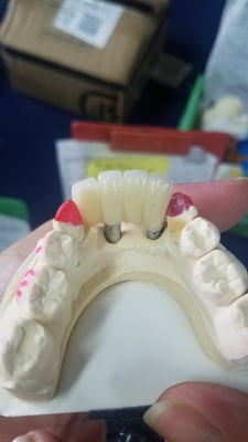 Ровная поверхностная Biocompatible крона зуба Zirconia легкая поддерживает