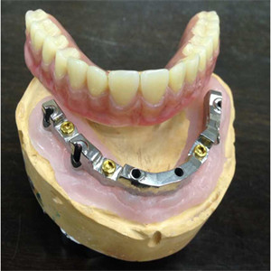 Безопасность лаборатории высокого биологического взаимо- Denture удобосмешиваемости зубоврачебная имплантирует