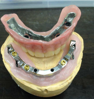 Безопасность лаборатории высокого биологического взаимо- Denture удобосмешиваемости зубоврачебная имплантирует