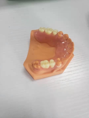 3D напечатало Dentures для зубоврачебных лабораторий основанных на цифровых данных