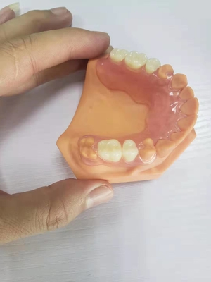 3D напечатало Dentures для зубоврачебных лабораторий основанных на цифровых данных
