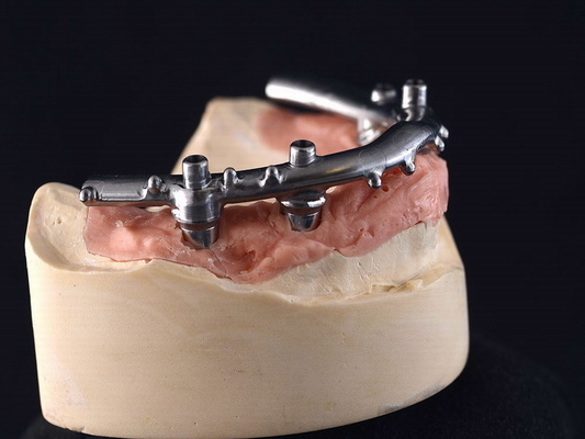 CNC титана All-On-4 имплантирует обеспеченные Dentures для зубоврачебной клиники