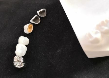 Подгонянная коррозионная устойчивость металла зубоврачебной кроны фарфора PFM полная