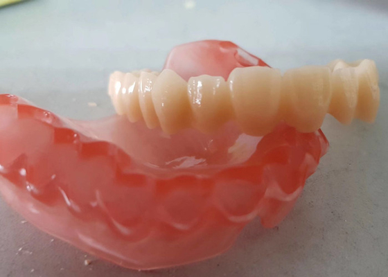 Реалистический OEM 3D цифровых данных напечатал зубоврачебные модели для исследования дантиста