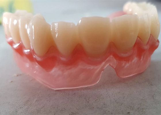 Реалистический OEM 3D цифровых данных напечатал зубоврачебные модели для исследования дантиста