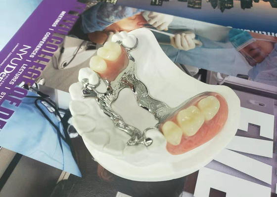 Natrural затеняет 3D печатая фиксированный съемный Denture для исследования дантиста