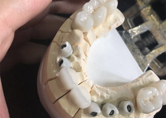 Кроны превосходное Biocompatibility свободного белого Zirconia металла зубоврачебные