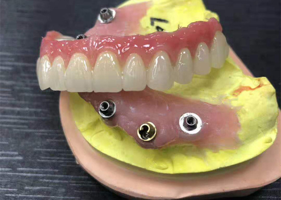 Имплантируйте крону Zirconia устоя зубоврачебную естественную совсем на 4 Dentures