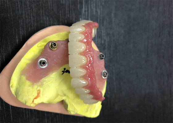 Имплантируйте крону Zirconia устоя зубоврачебную естественную совсем на 4 Dentures