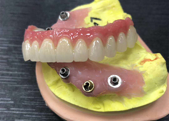Имплантируйте крону Zirconia устоя зубоврачебную естественную совсем на 4 Dentures