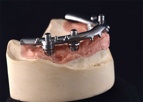 Твердость Dentures зубных имплантатов высокой плотности PFM сильная продолжительная