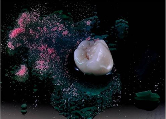 Ультра крепко лощить Все-керамический полировать кроны имплантируйте Dentures зубоврачебные
