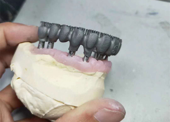 Лаборатория прочного принтера CAD CAM PFM 3D зубоврачебная печатает для исследования