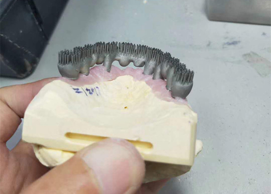 Лаборатория прочного принтера CAD CAM PFM 3D зубоврачебная печатает для исследования