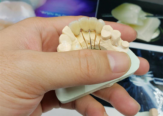 Крона фарфора OEM безопасности коррозионностойкая полностью керамический естественный взгляд