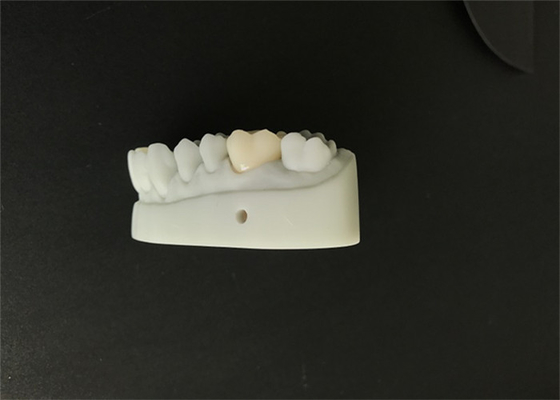 OEM 3D напечатал зубоврачебный дизайн CAD CAM моделей для лаборатории Denture